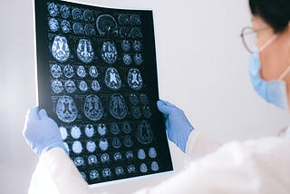 A Nurosurgen looking at a CAT SCAN of the human brain. He’s wearing blue medical gloves and a blue surgical mask with his white doctor’s coat.