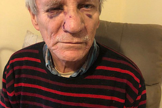 72 Year Old Olympian Assaulted