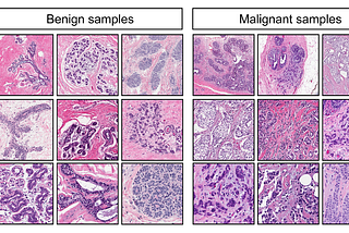 Building a Breast Cancer Biopsy Classification Using Multiple Feature Logistic Regression