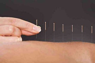 Acupuncture and its Innovations