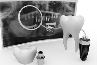 Advancements in Dentistry: Enhancing Oral Care Today