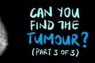 Can You Find the Breast Tumours? (Part 3 of 3)