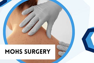 Mohs Surgery Techniques and Innovations