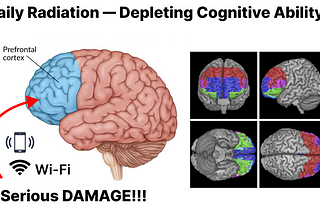 Hopping Attention Syndrome — 3 Simple Things That are Killing You | Damaged Prefrontal Cortex