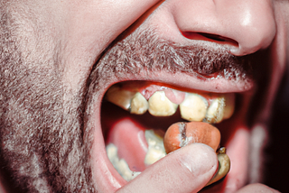 What Your Yellow Teeth Say About Your Oral Health – And Why It’s Not All Bad News.