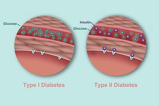 Type 1 vs. Type 2 Diabetes