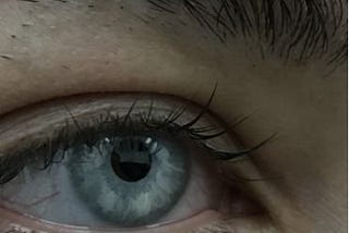 Benefits of Cosmetic Eye Colour Change Surgery