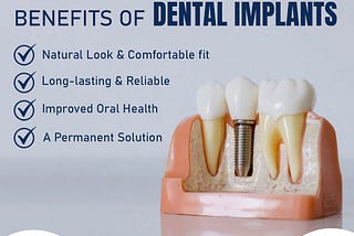 Dental Implant in Dubai