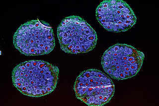 Building a Brain: A Deep Dive into Brain Organoids