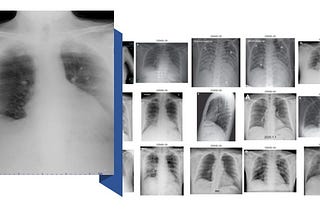 COVID-19 Case Study with CNN