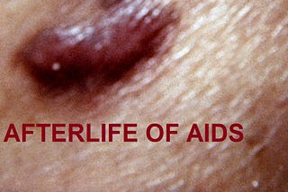 The Afterlife of AIDS