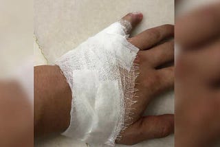 How To Deal With A Wound In A Crisis Without Going to the ER