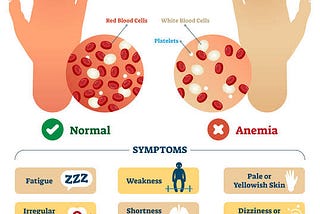 ANEMIA