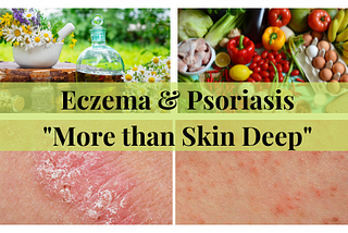 Eczema & Psoriasis — “More than Skin Deep”