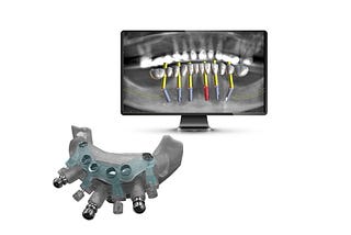 image3dconversion.com/article/guided-implantology-an-in-depth-look-at-techniques-and-benefits