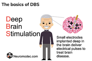 Expansion of Neurotech options for people with Parkinson’s disease.