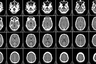 Will imaging-based biomarkers of psychiatric conditions ever be clinically useful?