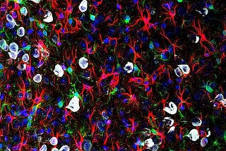 Untangling the Mysteries of the Brain