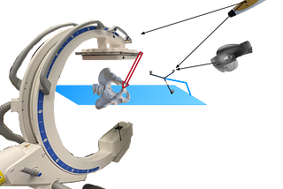 Frame Transformations in Computer Integrated Surgery