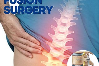 Spinal Fusion Surgery : A Ray Of Hope For Ailing Backs