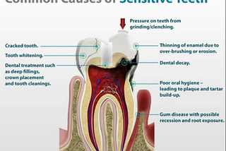 People usually neglect dental hygiene until they start getting pain in there jaw.