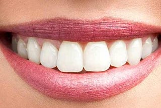 Dental Implants Can Bring Back a Pretty Smile on Someone’s Face