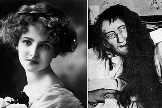 The lost girl, 1874 Blanche Monnier was a Parisian socialite, known for her beauty. In France, she is referred to as “La Séquestrée de Poitiers” which means “The Confined Woman of Poitiers”. The story behind this title is tragic beginning with a love story that ended poorly.