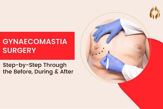 Gynecomastia Surgery: Step-by-Step Through the Before, During & After