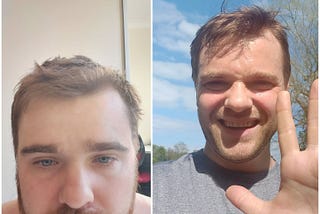 Quitting Alcohol for 100 days-Life is Getting Better Every Day.