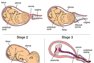 Stages of Labor and Birth