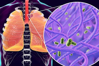 Whooping Cough is on the Rise: What You Need to Know and Why It’s Spreading So Fast