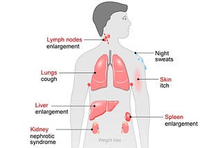 Where to Buy Ibrutinib for Lymphoma Treatment Online from India?