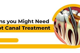 Some Signs and Symptoms that you need Root Canal