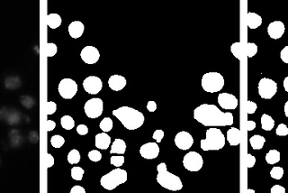 Cell Nuclei Segmentation using VGG16-UNET And Double-UNET