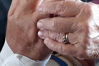 Hands of couple applying bandage.
