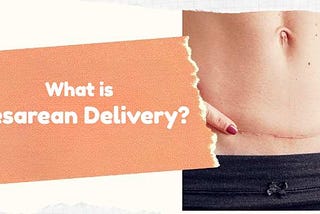 What is Cesarean Delivery?