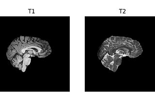 Deep-learning-based 3D Deformable Registration of T2-weighted Images