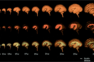 I/O for Your Cerebral Cortex