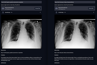 A new generative model for radiology
