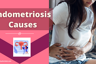 What Causes Endometriosis?