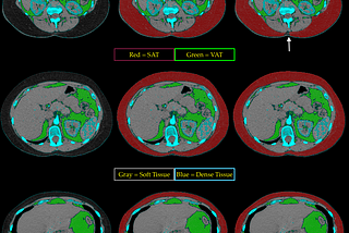 Deep Learning in Medical Imaging VI