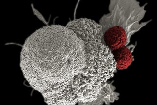 Scientists Discover T Cells That Kill Cells From Solid Tumors