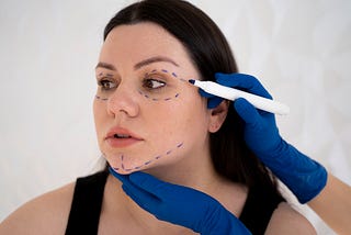 Everything You Need to Know Before Getting a Mini Facelift