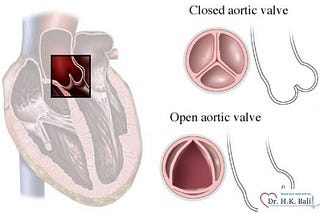 What are the Symptoms of Heart Valve Problems?