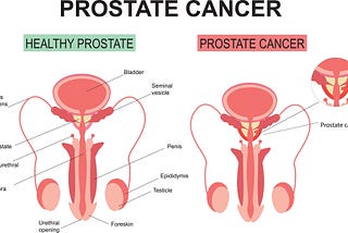 What are the best drugs for Prostate Cancer?