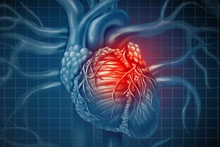 iCHD — Predicting Heart Disease