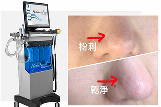 水飛梭真的有效嗎？地表最強水飛梭懶人包 — 最公正的價格、效果、評價彙整