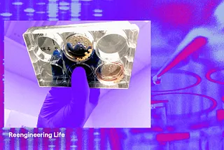 Mini Neanderthal Brains Could Reveal the Origins of Psychiatric Disorders