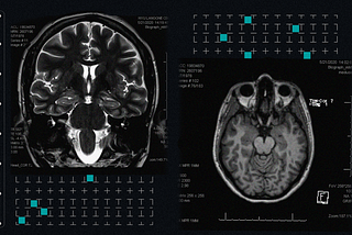 What Covid-19 Did to My Brain