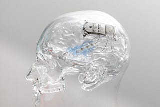Shocking the Brain to Treat the Stomach